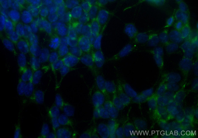 STMN2 Antibody in Immunocytochemistry (ICC/IF)