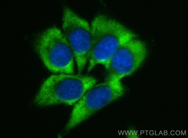 CYP7B1 Antibody in Immunocytochemistry (ICC/IF)