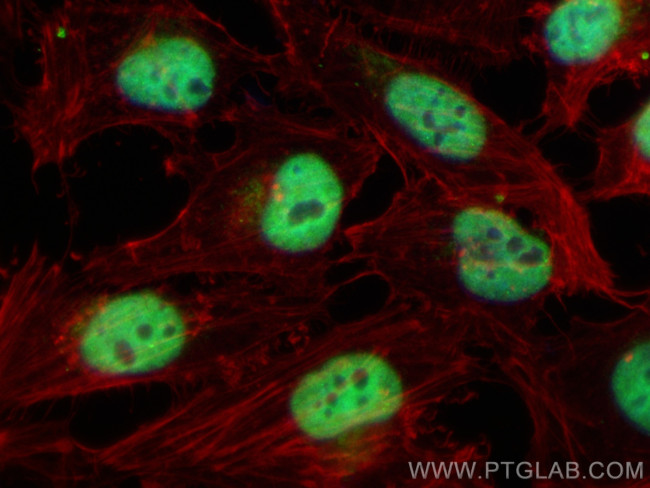 CUX2 Antibody in Immunocytochemistry (ICC/IF)