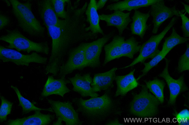 EIF2S1 Antibody in Immunocytochemistry (ICC/IF)
