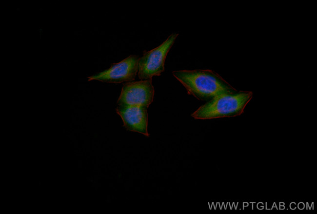 EIF2S1 Antibody in Immunocytochemistry (ICC/IF)