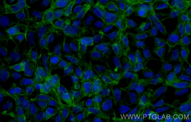 CLDN16 Antibody in Immunocytochemistry (ICC/IF)
