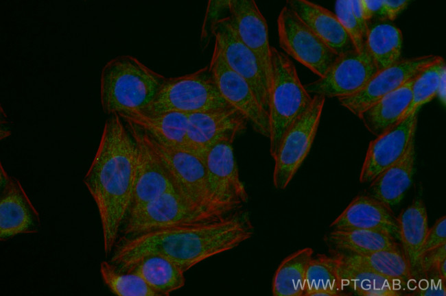 FDX1 Antibody in Immunocytochemistry (ICC/IF)