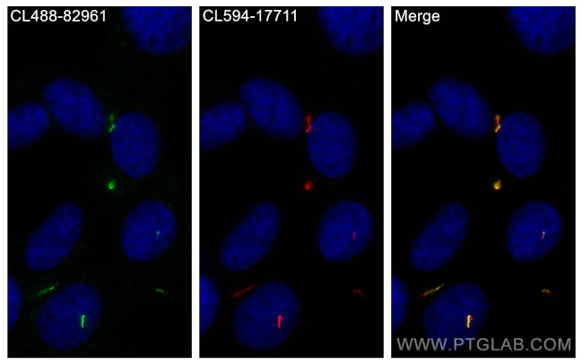BBS4 Antibody in Immunocytochemistry (ICC/IF)