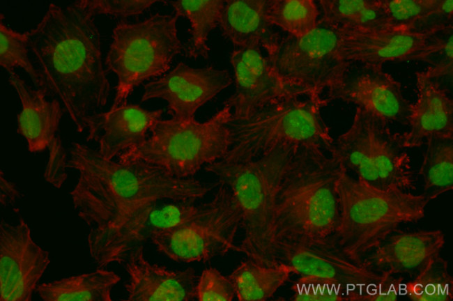 SNIP1 Antibody in Immunocytochemistry (ICC/IF)