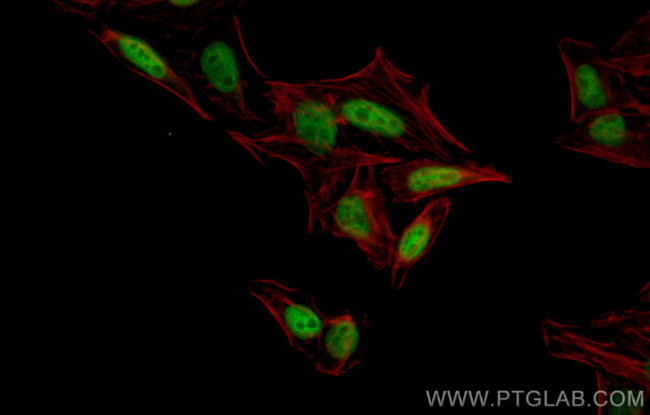 POU4F3 Antibody in Immunocytochemistry (ICC/IF)
