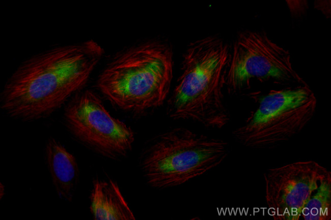 CCDC23 Antibody in Immunocytochemistry (ICC/IF)