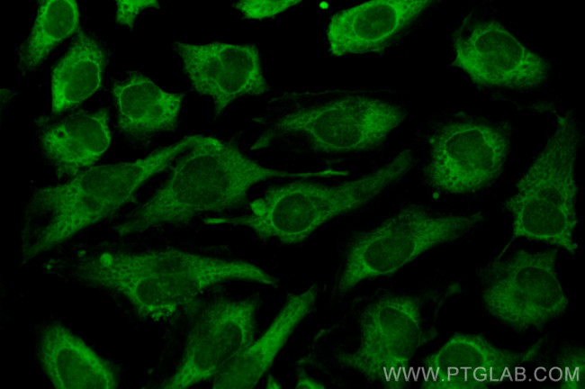 MTAP Antibody in Immunocytochemistry (ICC/IF)