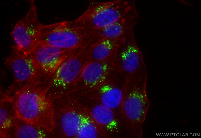 golgin 97 Antibody in Immunocytochemistry (ICC/IF)