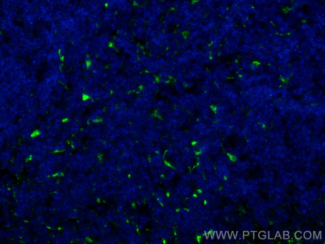 CD68 Antibody in Immunohistochemistry (Paraffin) (IHC (P))