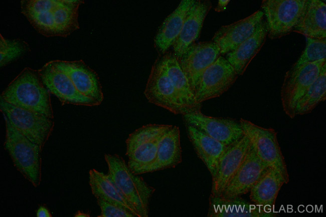 FDFT1 Antibody in Immunocytochemistry (ICC/IF)