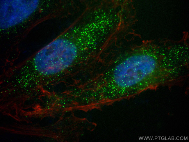 ABCD1 Antibody in Immunocytochemistry (ICC/IF)