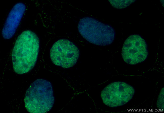 SALL4 Antibody in Immunocytochemistry (ICC/IF)