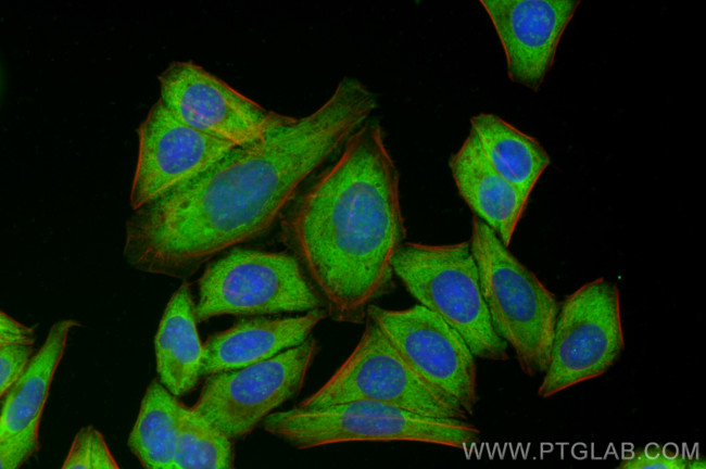 LCMT2 Antibody in Immunocytochemistry (ICC/IF)