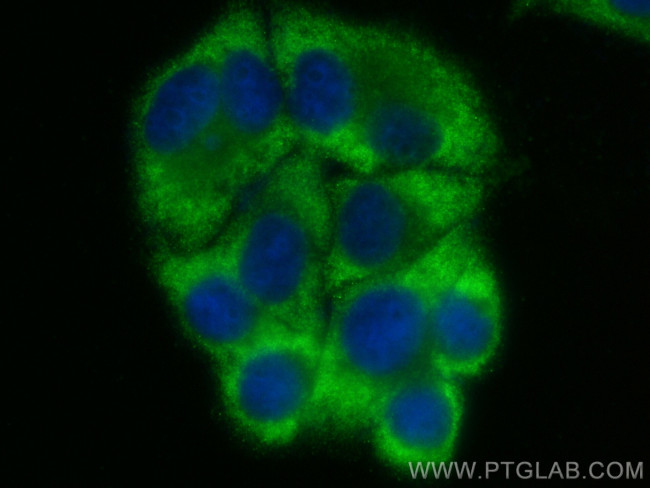 PFAS Antibody in Immunocytochemistry (ICC/IF)