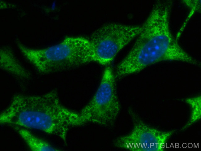 STK39 Antibody in Immunocytochemistry (ICC/IF)