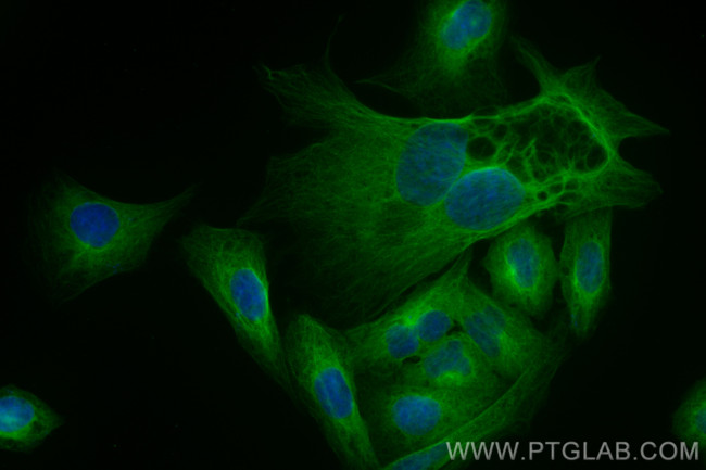CA11 Antibody in Immunocytochemistry (ICC/IF)