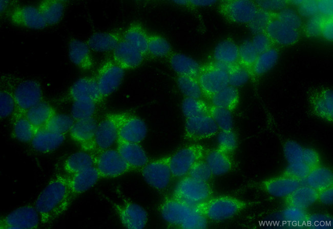 GDNF Antibody in Immunocytochemistry (ICC/IF)