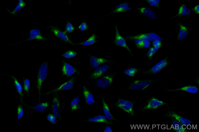 COPA Antibody in Immunocytochemistry (ICC/IF)