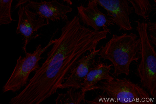 TGOLN2, TGN46 Antibody in Immunocytochemistry (ICC/IF)