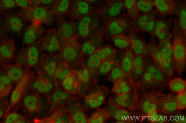 OGT Antibody in Immunocytochemistry (ICC/IF)