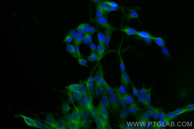CELSR2 Antibody in Immunocytochemistry (ICC/IF)