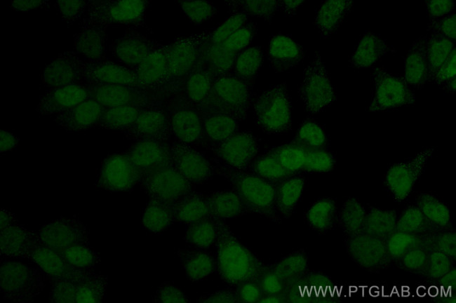 NSD3 Antibody in Immunocytochemistry (ICC/IF)