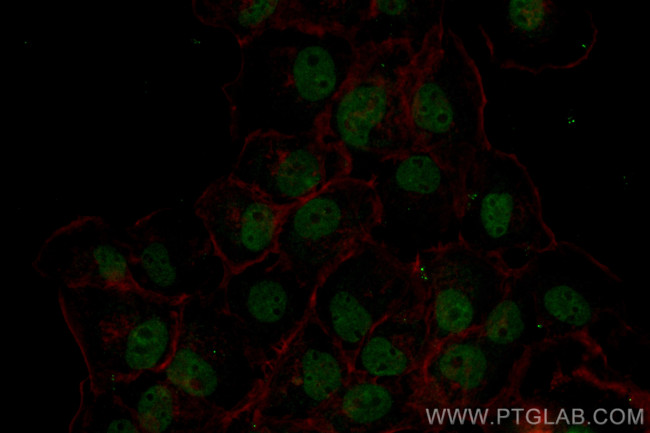 HNRPDL Antibody in Immunocytochemistry (ICC/IF)