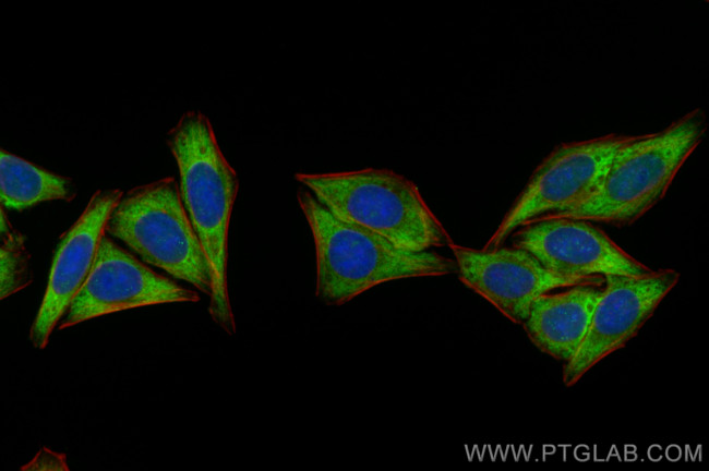 RNF31/HOIP Antibody in Immunocytochemistry (ICC/IF)