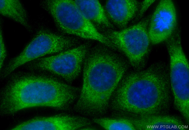 GRP94 Antibody in Immunocytochemistry (ICC/IF)