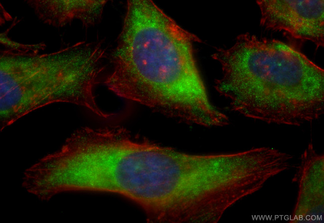TIMP1 Antibody in Immunocytochemistry (ICC/IF)