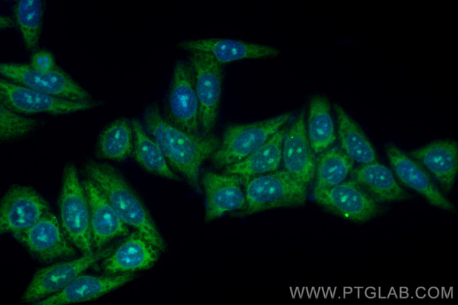 TYK2 Antibody in Immunocytochemistry (ICC/IF)