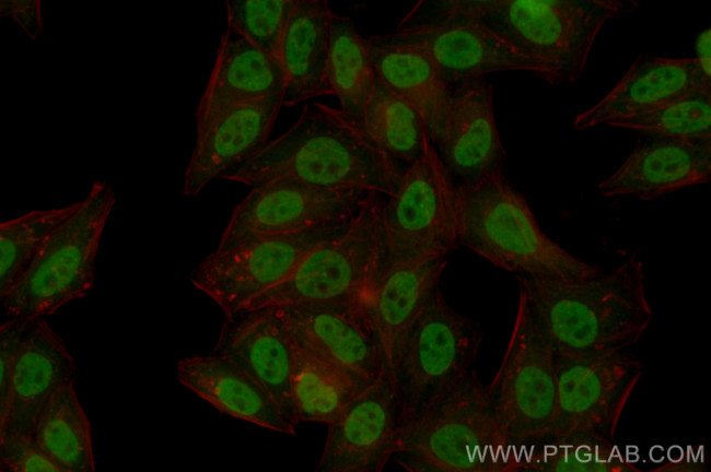HIC2 Antibody in Immunocytochemistry (ICC/IF)