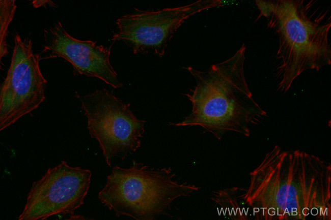 ROCK1 Antibody in Immunocytochemistry (ICC/IF)