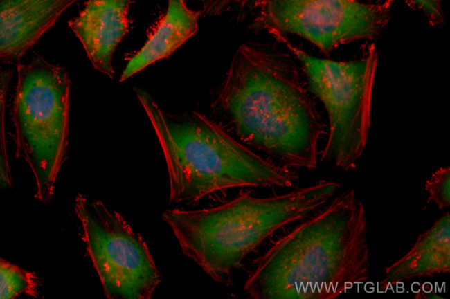 TGFB2 Antibody in Immunocytochemistry (ICC/IF)