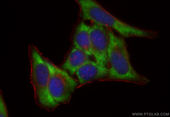 SAR1A Antibody in Immunocytochemistry (ICC/IF)