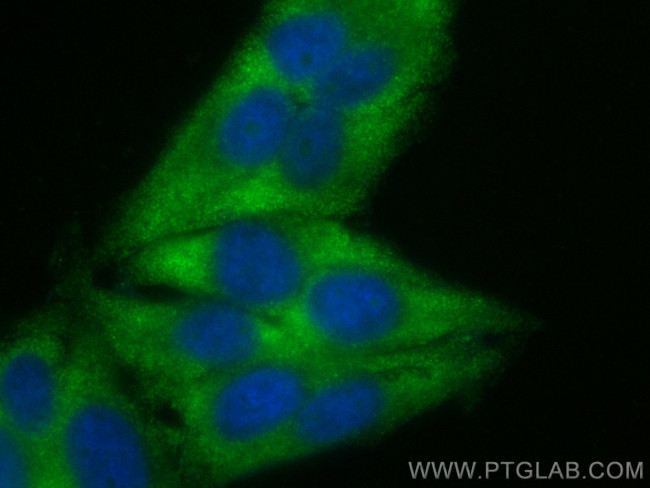 TRIM54 Antibody in Immunocytochemistry (ICC/IF)