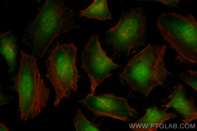 TPR Antibody in Immunocytochemistry (ICC/IF)