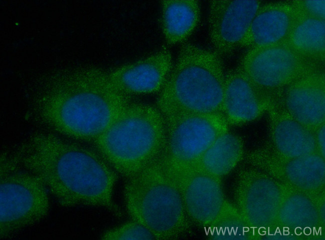 MMP13 Antibody in Immunocytochemistry (ICC/IF)