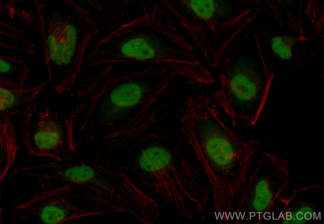 HIRA Antibody in Immunocytochemistry (ICC/IF)