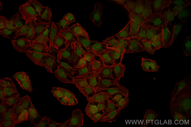 SLC12A8 Antibody in Immunocytochemistry (ICC/IF)