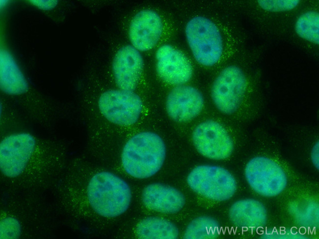 MKNK2 Antibody in Immunocytochemistry (ICC/IF)