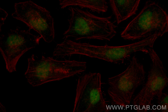 MLLT1 Antibody in Immunocytochemistry (ICC/IF)