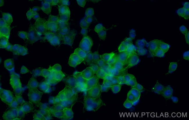SNAP25 Antibody in Immunocytochemistry (ICC/IF)