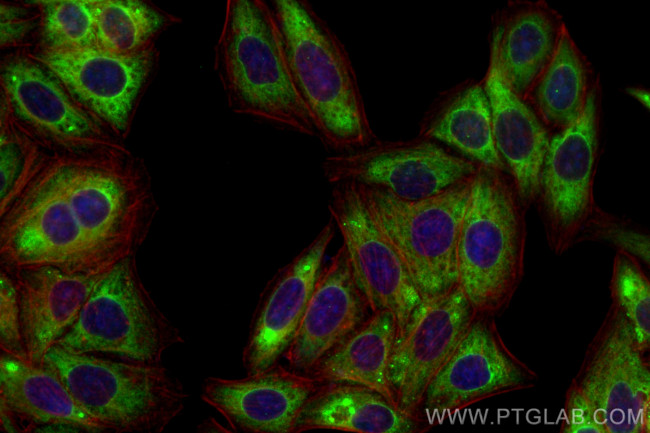 DGAT2 Antibody in Immunocytochemistry (ICC/IF)