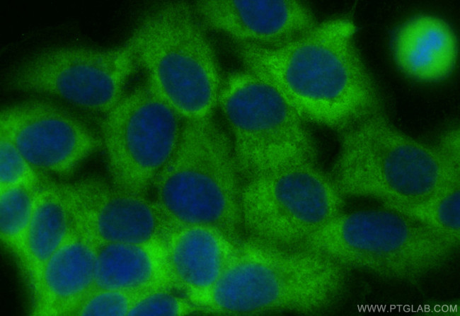 EFHD2 Antibody in Immunocytochemistry (ICC/IF)