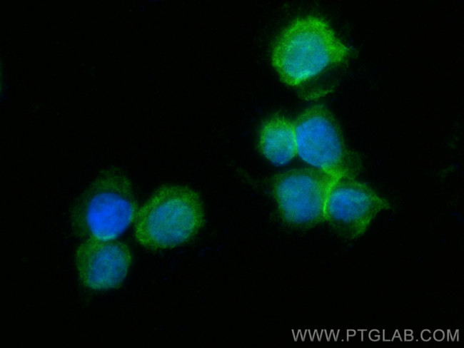 DOCK8 Antibody in Immunocytochemistry (ICC/IF)