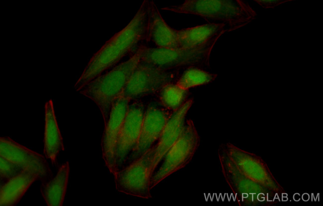 NUP85 Antibody in Immunocytochemistry (ICC/IF)