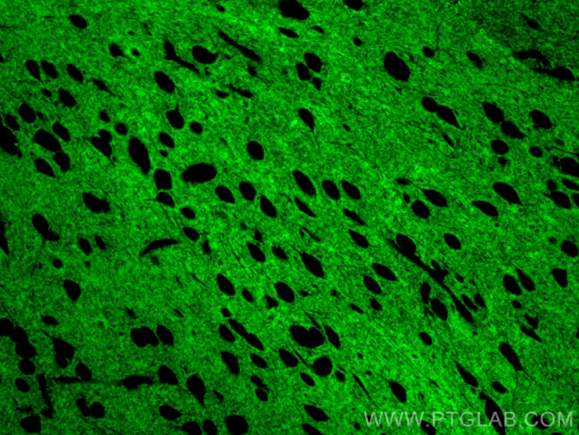 STX1B Antibody in Immunohistochemistry (Paraffin) (IHC (P))