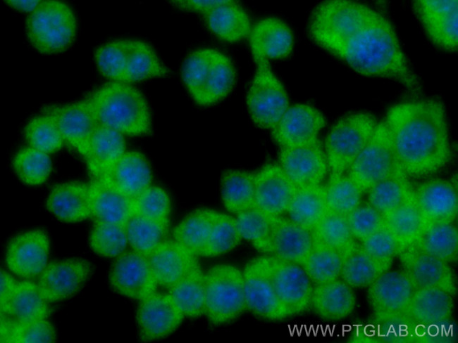 SAT1 Antibody in Immunocytochemistry (ICC/IF)